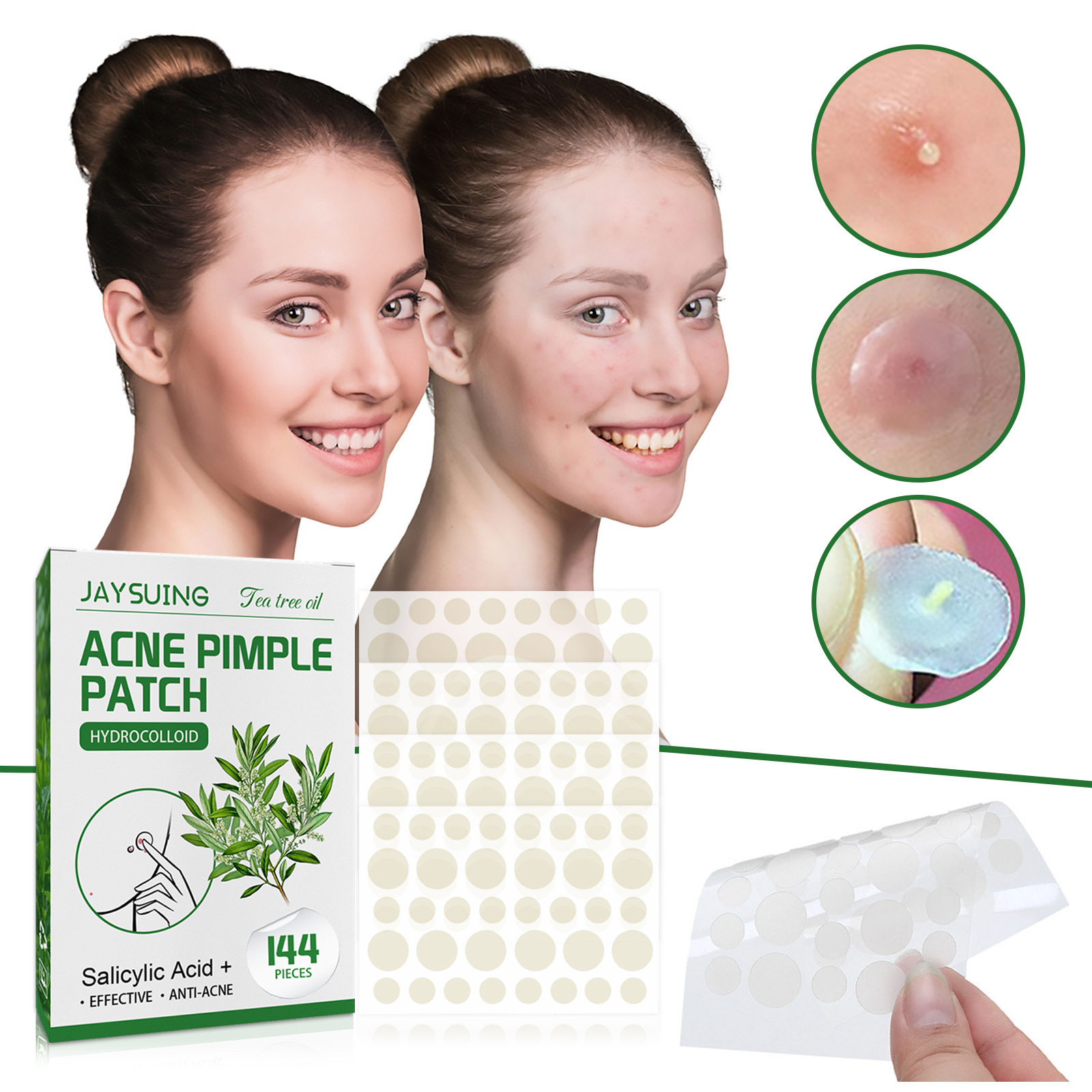 Hydrocolloid Acne Patches - Ab - Hydrocolloid Pimple Patch ulasan dan harga