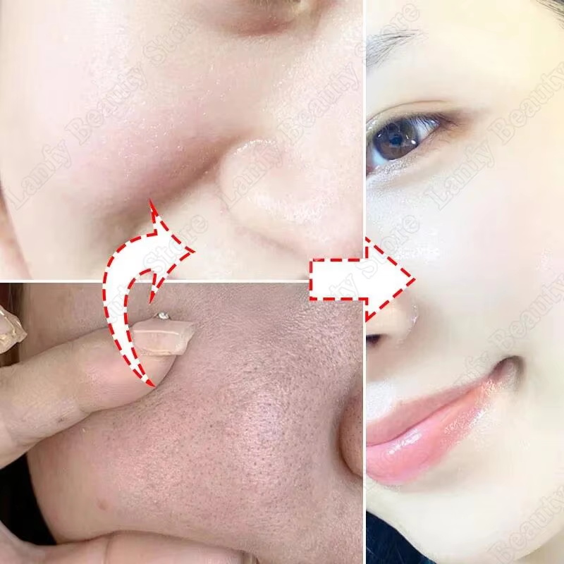 Salicylic Acid Pore Clearing C - Salicylic Acid Blackhead Remover ulasan dan harga