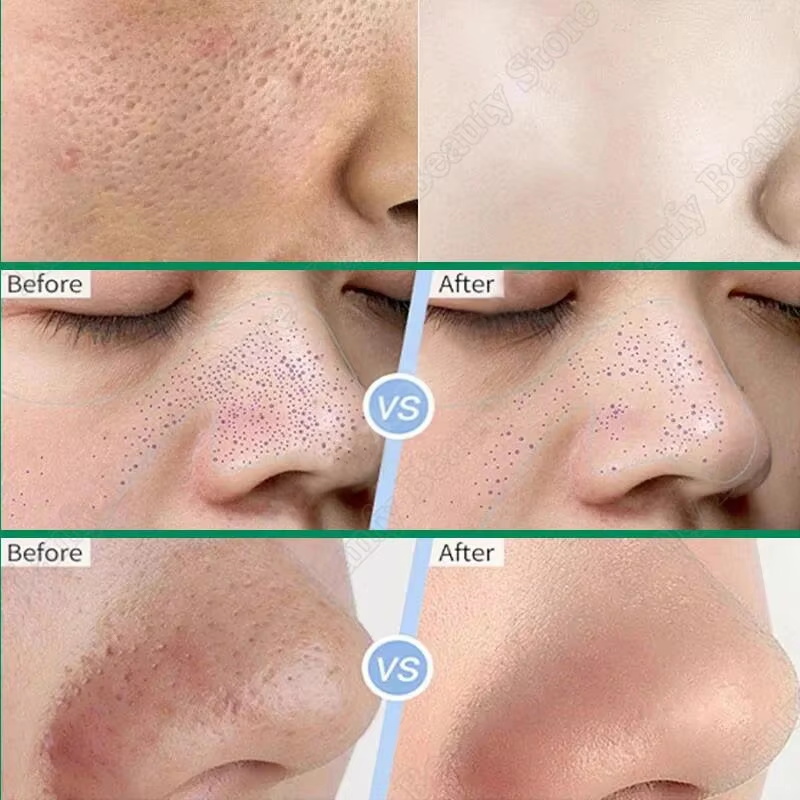 Salicylic Acid Pore Clearing C - Salicylic Acid Blackhead Remover ulasan dan harga